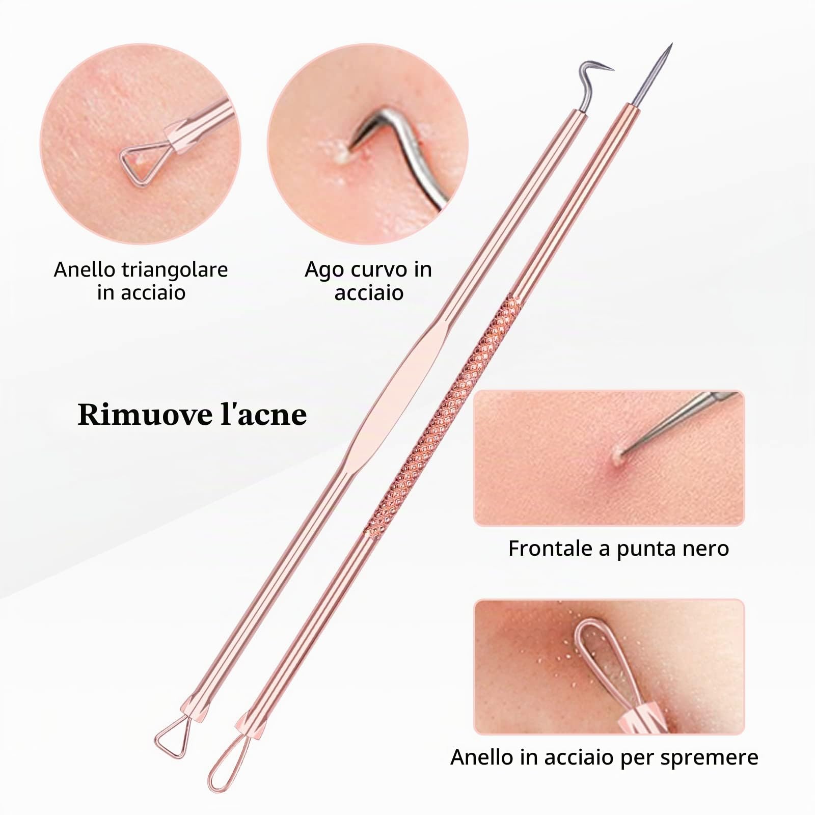 DUcare Set 4 Pezzi Estrattore Punti Neri Oro Acciaio Inox